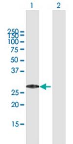 MED29 Antibody in Western Blot (WB)