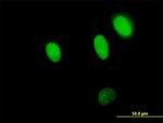 NPLOC4 Antibody in Immunocytochemistry (ICC/IF)