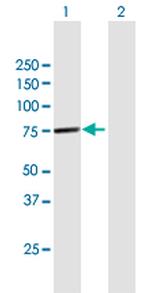 NPLOC4 Antibody in Western Blot (WB)