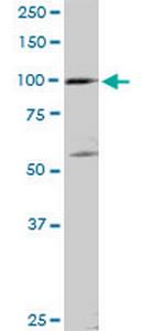 SCYL2 Antibody in Western Blot (WB)