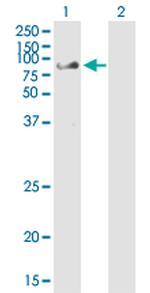 CHFR Antibody in Western Blot (WB)