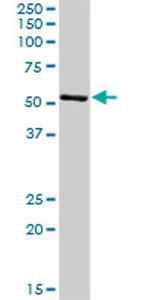 CNDP2 Antibody in Western Blot (WB)