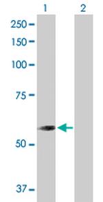 CNDP2 Antibody in Western Blot (WB)