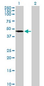 AGK Antibody in Western Blot (WB)