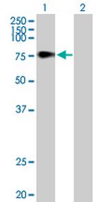 TDP1 Antibody in Western Blot (WB)