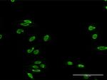 TDP1 Antibody in Immunocytochemistry (ICC/IF)