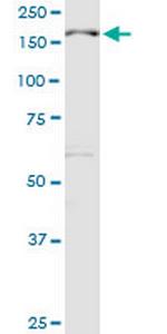 MBD5 Antibody in Western Blot (WB)