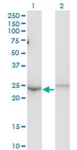 MBD5 Antibody in Western Blot (WB)