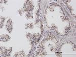 CHGN Antibody in Immunohistochemistry (Paraffin) (IHC (P))