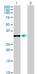 CHGN Antibody in Western Blot (WB)