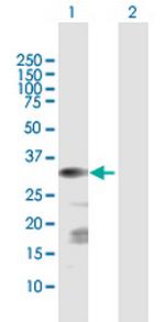 CSGALNACT1 Antibody in Western Blot (WB)