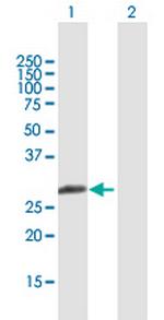 MBNL3 Antibody in Western Blot (WB)