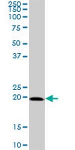 SELS Antibody in Western Blot (WB)