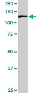 CAND1 Antibody in Western Blot (WB)