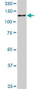 CAND1 Antibody in Western Blot (WB)