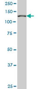 CAND1 Antibody in Western Blot (WB)