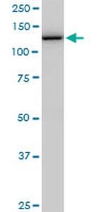 CAND1 Antibody in Western Blot (WB)