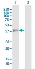 PBK Antibody in Western Blot (WB)