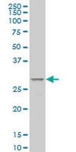 MESP1 Antibody in Western Blot (WB)