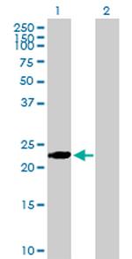 BIN3 Antibody in Western Blot (WB)