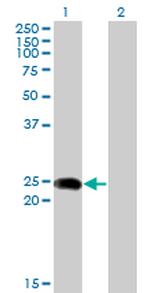 BIN3 Antibody in Western Blot (WB)