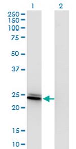 BIN3 Antibody in Western Blot (WB)