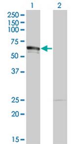 DMAP1 Antibody in Western Blot (WB)