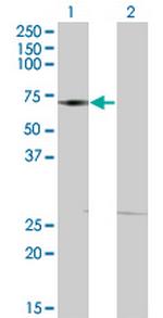 DMAP1 Antibody in Western Blot (WB)