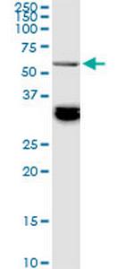 BAIAP2L1 Antibody in Western Blot (WB)