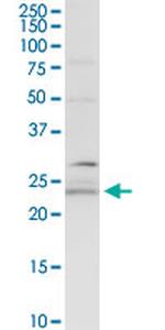 BCAP29 Antibody in Western Blot (WB)