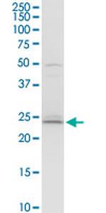 BCAP29 Antibody in Western Blot (WB)