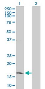 BARX1 Antibody in Western Blot (WB)