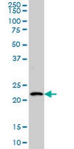 BARX1 Antibody in Western Blot (WB)