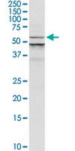 ALG1 Antibody in Western Blot (WB)