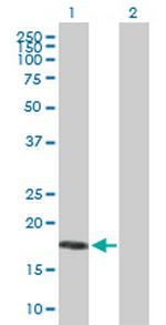 MRAP Antibody in Western Blot (WB)