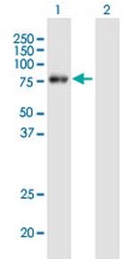 METTL3 Antibody in Western Blot (WB)