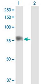 SPHK2 Antibody in Western Blot (WB)