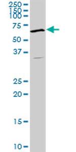 RAD18 Antibody in Western Blot (WB)