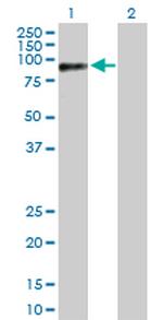 RAD18 Antibody in Western Blot (WB)