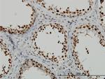 RAD18 Antibody in Immunohistochemistry (Paraffin) (IHC (P))