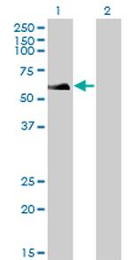 RAD18 Antibody in Western Blot (WB)