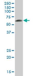 DPYSL5 Antibody in Western Blot (WB)