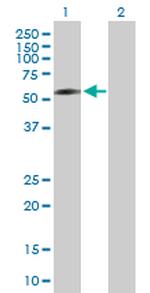 DPYSL5 Antibody in Western Blot (WB)