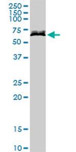 DPYSL5 Antibody in Western Blot (WB)