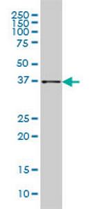 AKR1B10 Antibody in Western Blot (WB)