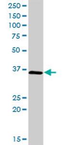 CIAPIN1 Antibody in Western Blot (WB)