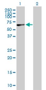 PNPLA2 Antibody in Western Blot (WB)