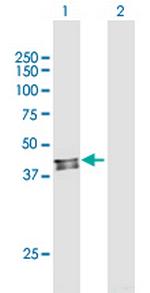 C6orf210 Antibody in Western Blot (WB)