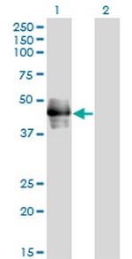 CD177 Antibody in Western Blot (WB)