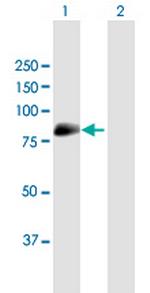 MAN1C1 Antibody in Western Blot (WB)